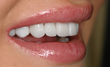 Amazing Smiles